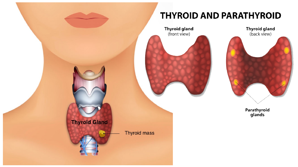 DIAGNOSING THYROID DISORDERS